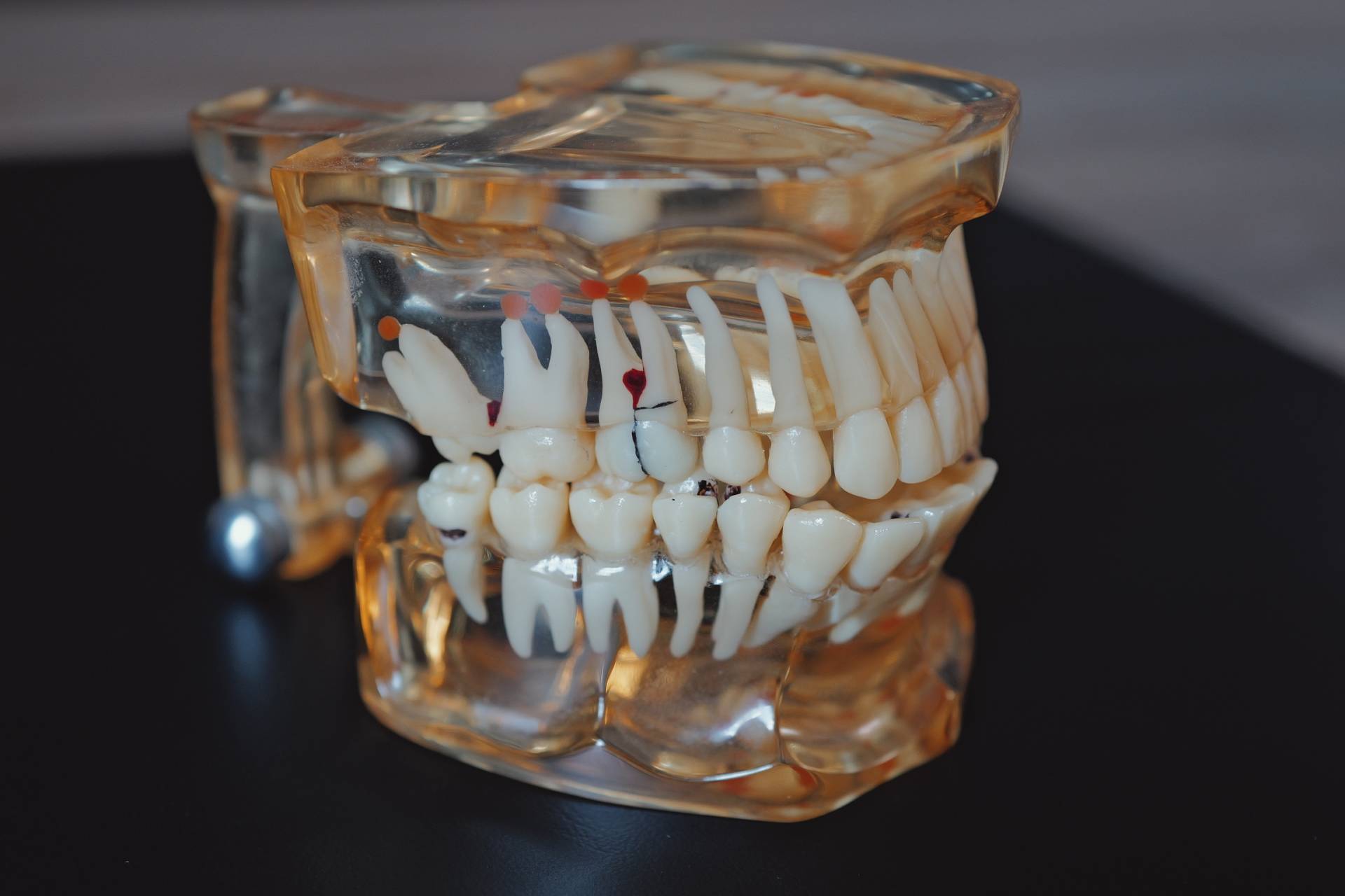 Proč je endodontické ošetření náročné – a proč stojí za svou cenu?
